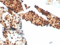 S100P Antibody (S100P/4386R) - Azide and BSA Free, Novus Biologicals 100